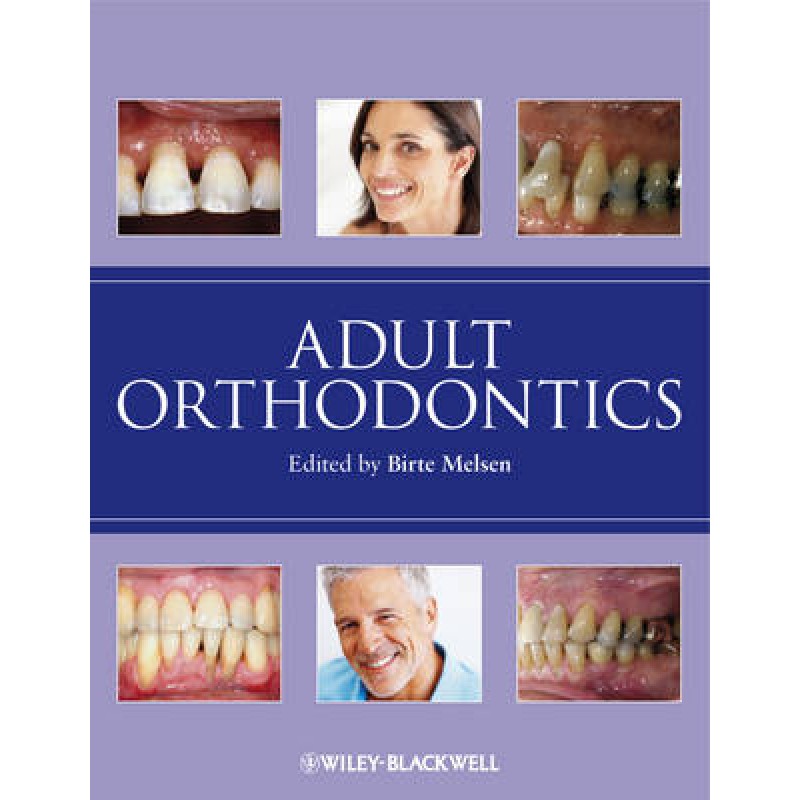 Adult Orthodontics